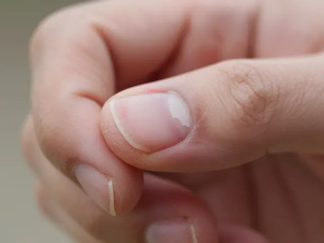 Jak obnovit nehtové lůžko po poškození nebo nehtové infekci