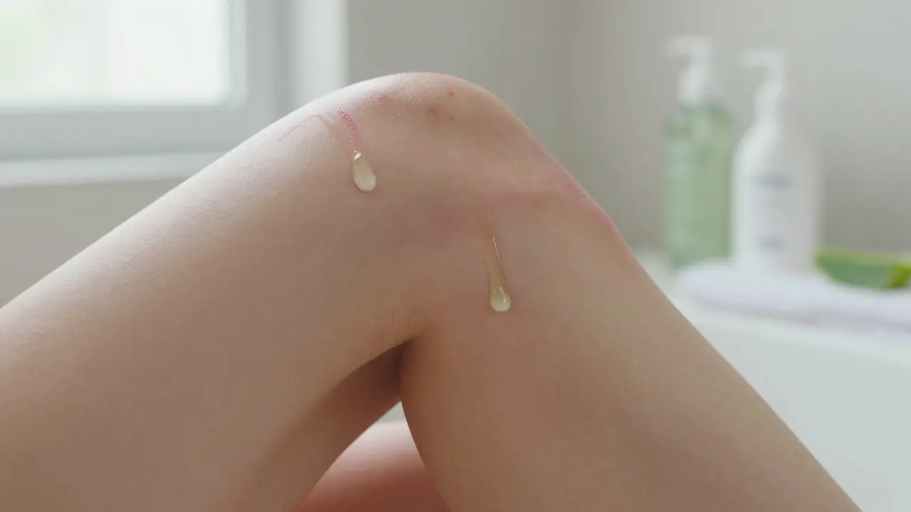 Jak se zbavit pupínků po depilaci: praktické rady a příčiny