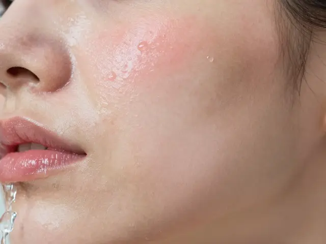 Čím zklidnit podrážděnou pokožku? Nejlepší ingredience a tipy